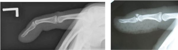 X-ray.JPG