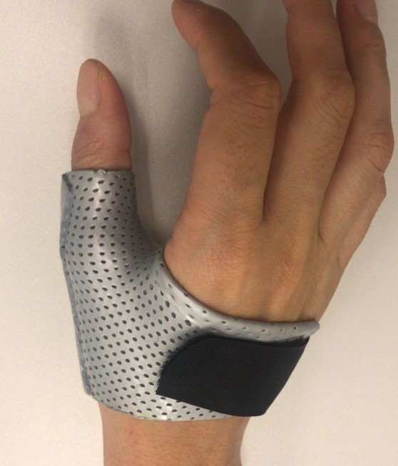 Splinting.jpg