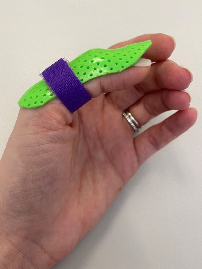 splinting 2.jpg