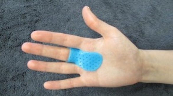 splinting.jpg