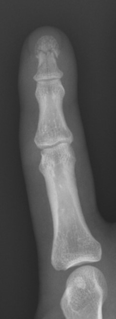 xray