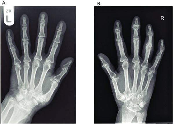 X-ray.jpg
